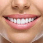 Smile Makeover in Turkey