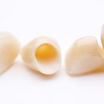 Zirconium Crowns in Turkey