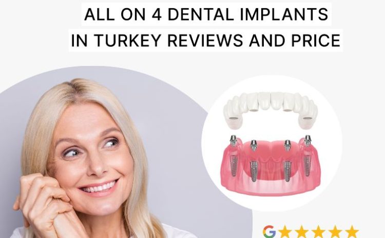 All on 4 Dental Implants in Turkey Reviews and Price