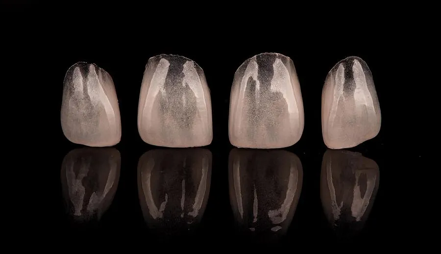 Porcelain Veneers