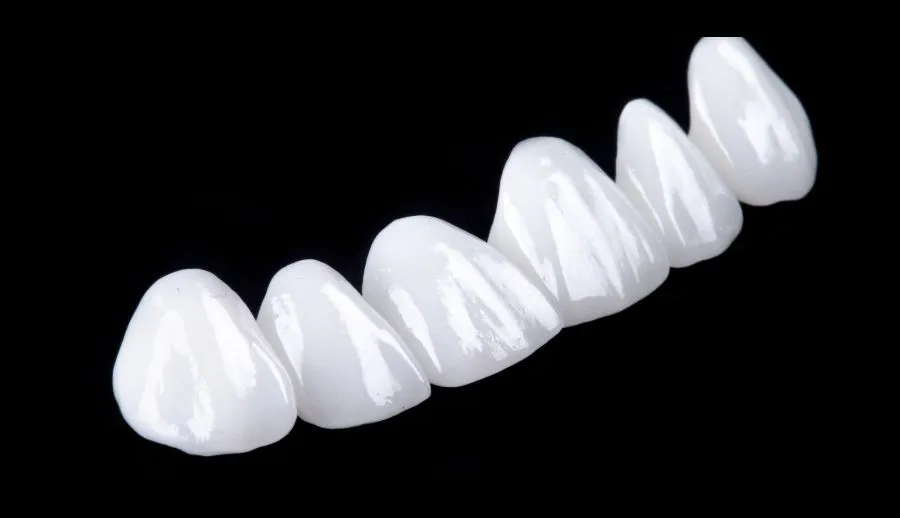 Zirconia Veneers