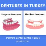 3D illustration comparing snap-on dentures and flexible dentures offered at Parmire Dental Centre Turkey.