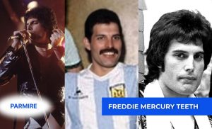 Freddie Mercury teeth