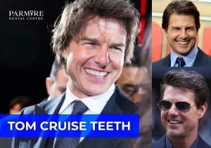 Tom Cruise Teeth