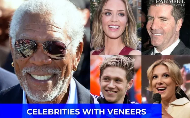 Celebrities with Veneers