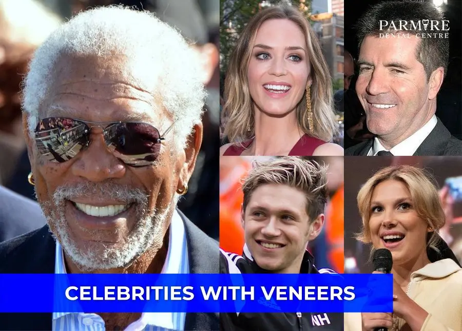 Celebrities with Veneers