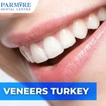 Veneers Turkey Parmire Clinic